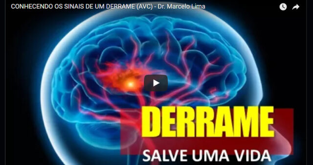 Conhecendo os sinais de um derrame (AVC) - Dr. Marcelo Lima