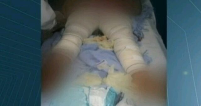 Criança atacada por cães recebe alta de hospital em Goiás