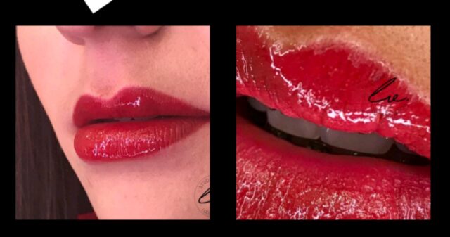 Dica de beleza Sala Vip, conheça um pouco sobre o procedimento Micro Labial