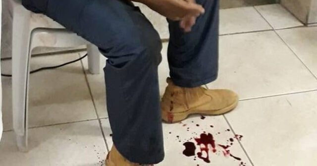 Menor é baleado durante assalto em Monte Carmelo