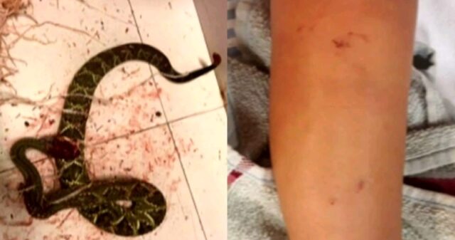 Criança sobrevive a dois ataques de cobra cascavel, no interior de Goiás