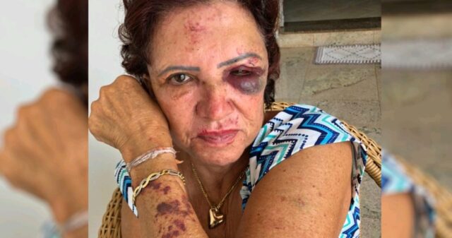 Ex-primeira-dama de Itaberaí é agredida durante assalto à sua residência