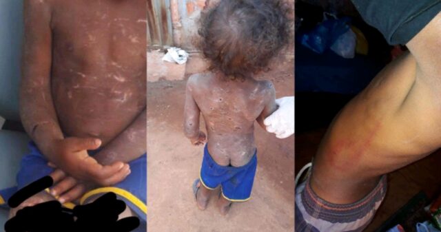 Criança morre e três irmãos ficam feridos após serem espancados por tios em Planaltina de Goiás, diz polícia