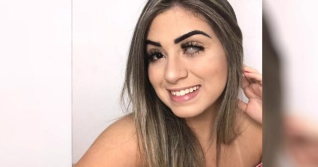 Catalana cega de um olho por causa de glaucoma é sucesso nas redes sociais contando história de superação: 'Tem que se aceitar'