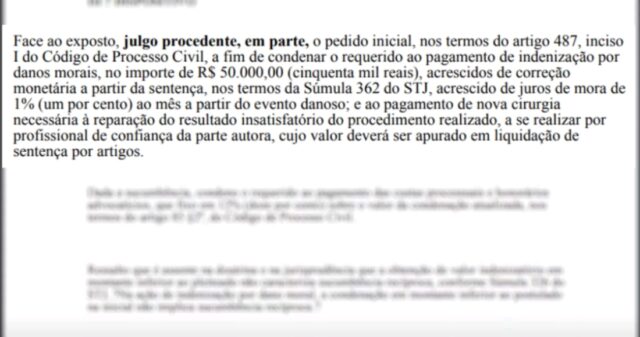 Juíza manda médico pagar R$ 50 mil a gari que ficou sem mamilos após cirurgia de redução das mamas