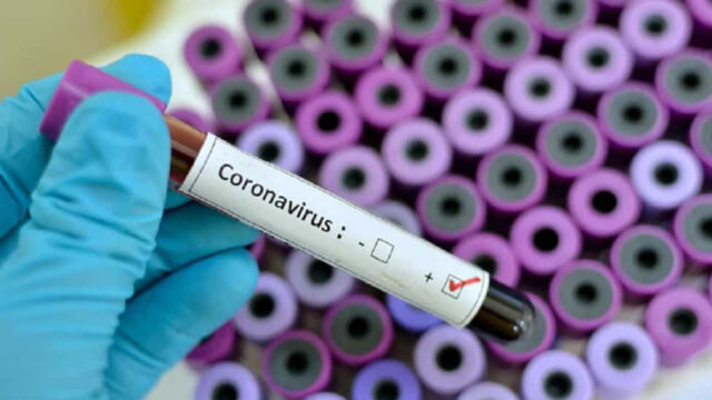 Leitos de enfermaria da rede estadual para pacientes com Covid-19 voltam a ficar 100% ocupados em Goiás