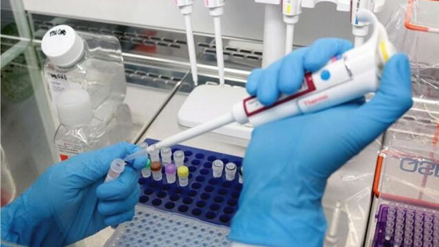 Goiás tem 181 casos da variante gama plus da Covid-19