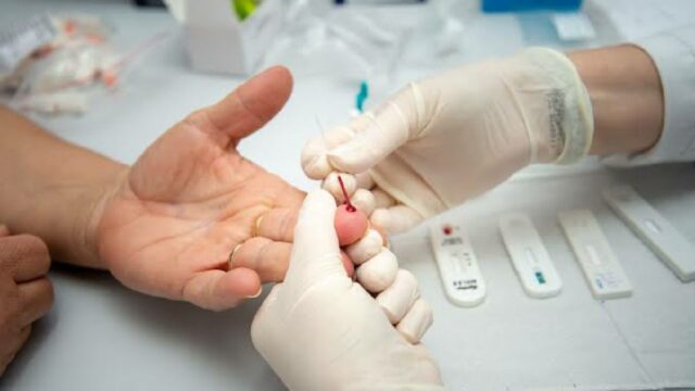 CORONAVÍRUS: Goiás 27.650 mortos e 1.755.152 infectados