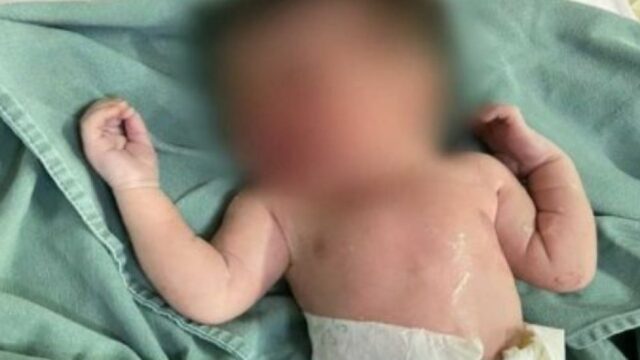 Mãe de bebê com “meio” coração luta para salvar filho