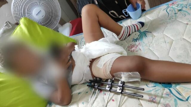 Criança gira no ar e é arremessada após ser atropelada por carro em Anápolis