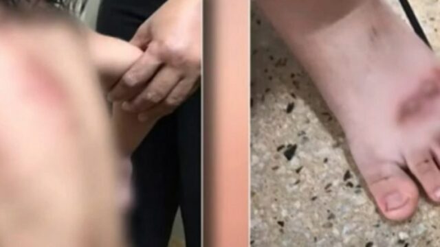 Criança de 2 anos é arrastada por carro durante briga dos pais, em Jataí