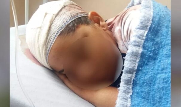 Jovem de 19 anos é atingida por golpes de marreta na cabeça, ex-padrasto é o principal suspeito