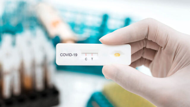 Covid-19: Semana começa com 1 óbito e mais 200 casos confirmados em Catalão