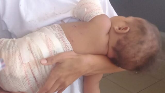 Mãe de bebê atingida por fogo de artifício relata pânico após crime: ‘Pensei que ela ia morrer’