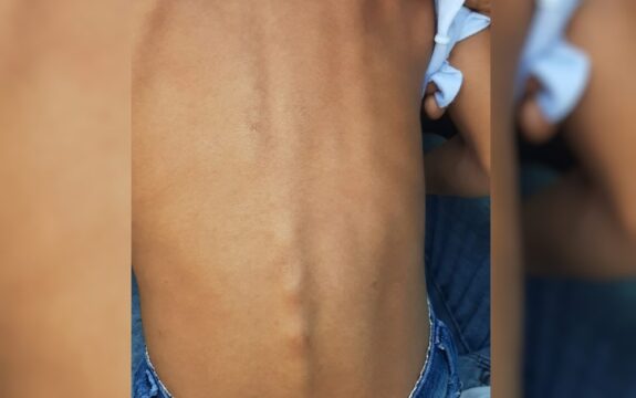 Mãe e padrasto são presos suspeitos de torturar crianças e deixá-las tremer de fome, em Mineiros