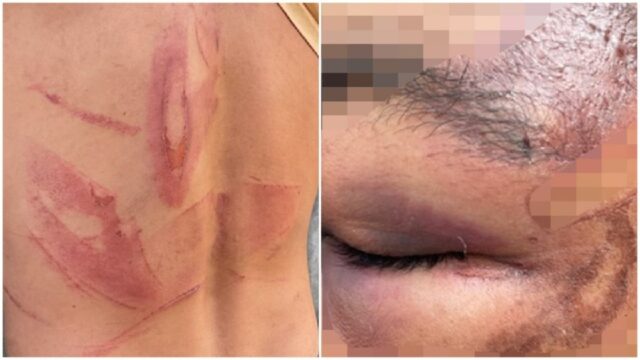 Polícia Civil investiga denúncia de que patrão agrediu trabalhadores rurais em Santa Cruz de Goiás
