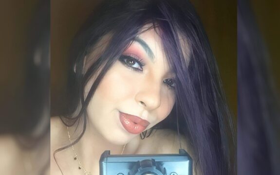 Jovem que teve corpo queimado por ex-companheiro recebe alta de hospital em Goiânia