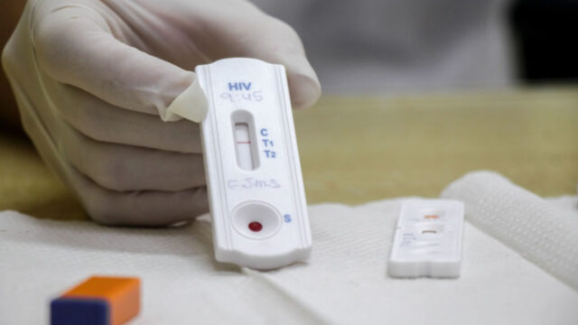 Rede Municipal de Saúde realiza teste rápido para HIV, Sífilis e Hepatites B e C