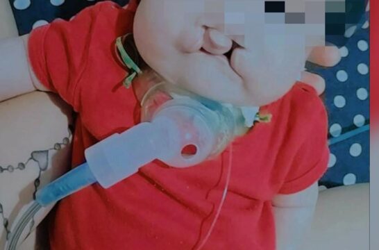 Solidariedade: Conheça a história de Pedro Gabriel, de 4 meses de idade; ele precisa da nossa ajuda