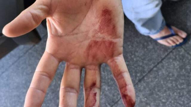 Homem é atacado por 3 pitbulls enquanto caminhava na rua com o filho em Uberlândia