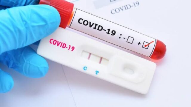 Em menos de uma semana, farmácias de Catalão sofrem com déficit de teste de Covid-19