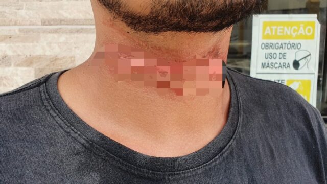 Motociclista fica ferido após enroscar pescoço em fio de fibra óptica solto e cair da moto, em Catalão