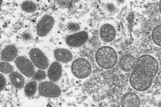Sobe para três a quantidade de moradores com suspeita de varíola dos macacos em Goiás, diz Saúde