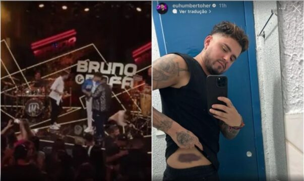 Cantor Humberto, da dupla com Ronaldo, mostra machucado após cair de palco durante gravação de DVD em Goiânia