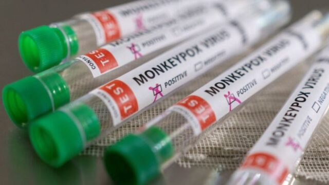 SES aguarda a chegada de insumos para realizar testes diagnósticos de varíola dos macacos em Goiás
