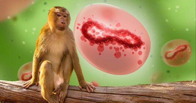 Saúde orienta grávidas sobre prevenção à varíola dos macacos