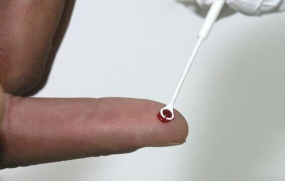 Catalão está entre as 24 cidades brasileiras a conquistar certificado pela eliminação da transmissão do HIV de mãe para filho