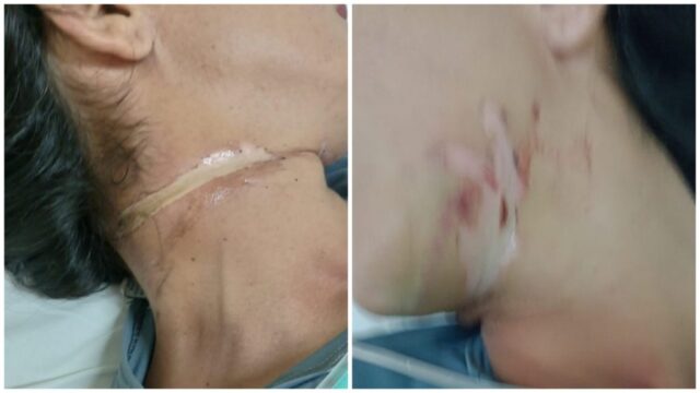Motociclista fica ferida após ser atingida por fio solto em Catalão
