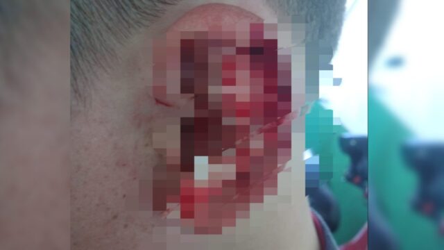 Goiandira: Secretaria de Educação do Estado (Seduc/GO) emite nota sobre o caso do estudante agredido em colégio estadual do município