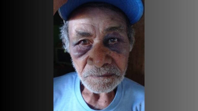 LUTO: Idoso de 81 anos, agredido covardemente em Catalão, morre na manhã deste domingo (16)