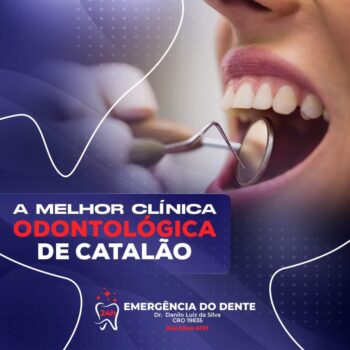Emergência do Dente