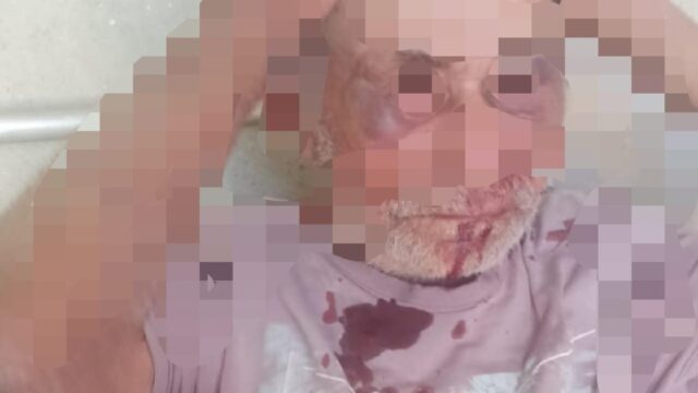 Video: Agressão brutal a idoso de 81 anos é capturada por câmeras de segurança em Catalão; Suspeito é preso em flagrante