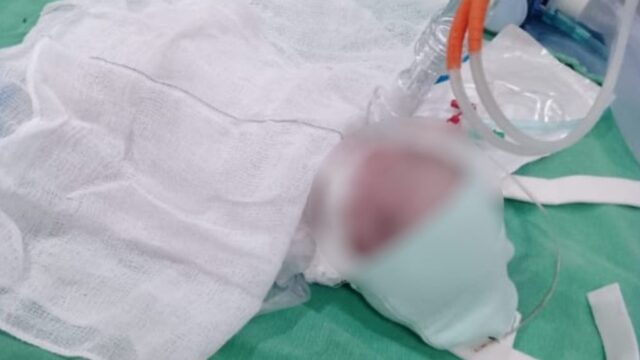 Corpo de bebê que morreu horas após nascer é trocado por de outro neném e enterrado pela família errada, denuncia mãe, em Luziânia