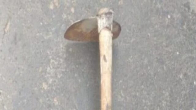 Caldas Novas: mulher fica gravemente ferida após ser agredida pelo companheiro com golpes de enxada