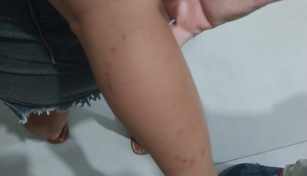 Batalhão Rural ajuda salvar criança de 2 anos vítima de ataque de serpente de aproximadamente 6 metros em Vicentinópolis; VÍDEO