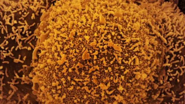 Nova subvariante da covid-19 é identificada em Mato Grosso