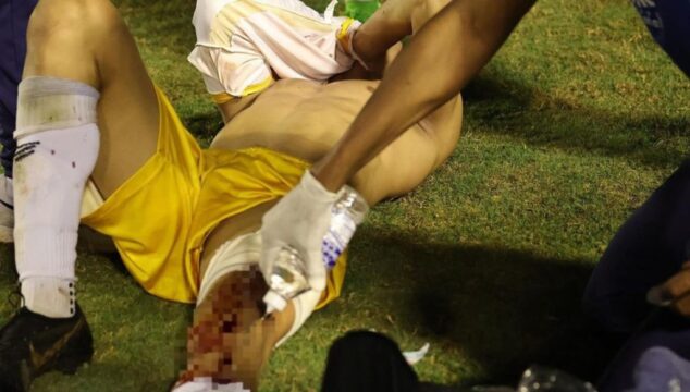 Policial atira em goleiro do Grêmio Anápolis, após jogo da Divisão de Acesso do Goianão contra o Centro Oeste