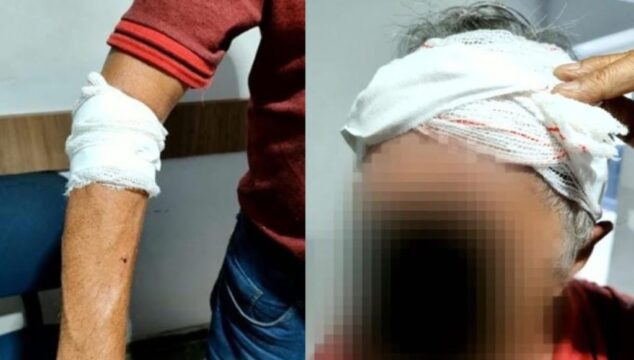 Idoso leva tijolada na cabeça após briga de trânsito em Caldas Novas