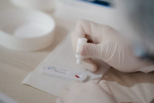 Governo de Goiás lança campanha Dezembro Vermelho de conscientização e luta contra o HIV/Aids