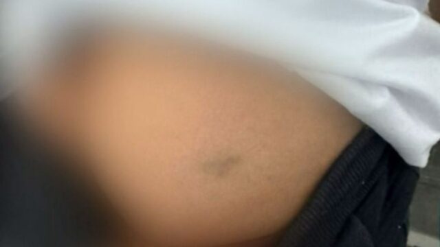 Mãe denuncia agressão a criança com TDAH em escola municipal de Palmelo