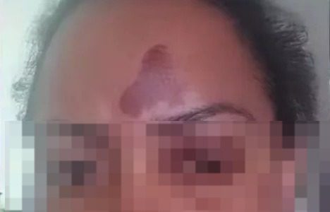 Mulher é arrastada por motorista de aplicativo em Uberlândia após falha em pagamento de corrida