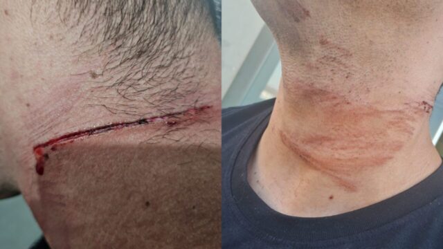 Policial militar fica ferido após fio enrolar no pescoço e provocar queda de moto em Catalão