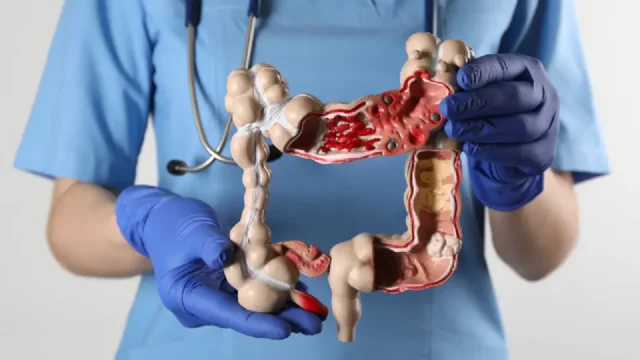 Estudo aponta que alimento abundante na culinária brasileira pode reduzir 20% risco de câncer de intestino, entenda