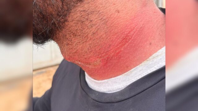 Motociclista fica ferido após se enroscar em fio de internet em Catalão