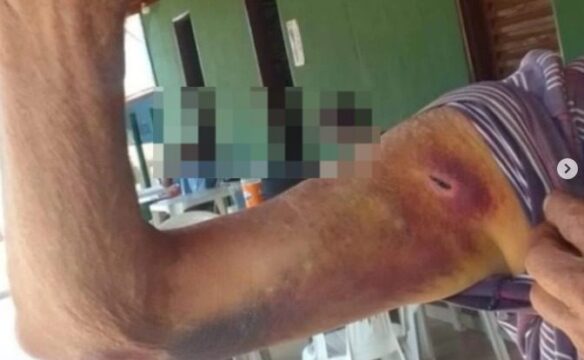 Mulher é presa em Orizona por maus-tratos e cárcere privado contra marido idoso e filho com deficiência