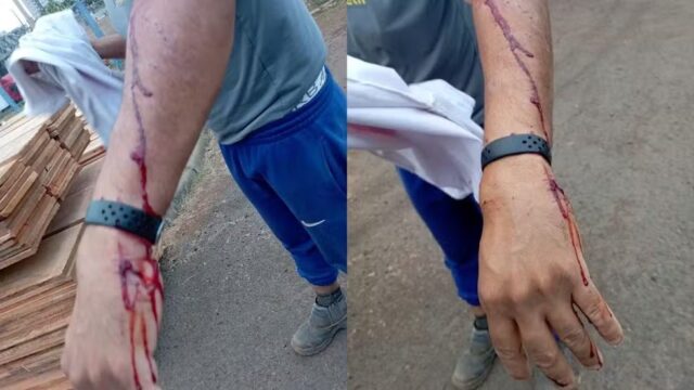 Homem é atacado por dois pitbulls enquanto ia para o trabalho em Uberlândia